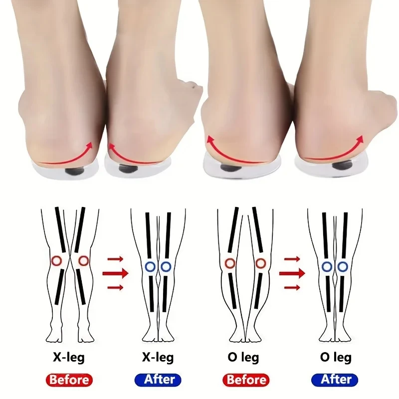 Women Shoes Types - 1 paio di solette ortopediche per