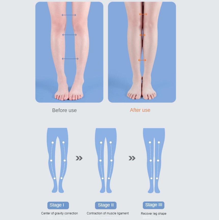 Soletta ortopedica in PU Suppo - Women Shoes Types recensione e prezzo